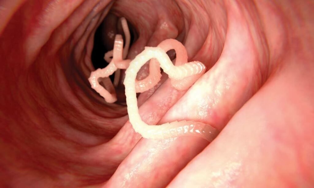 Tapeworms in Humans: Risks and Treatment