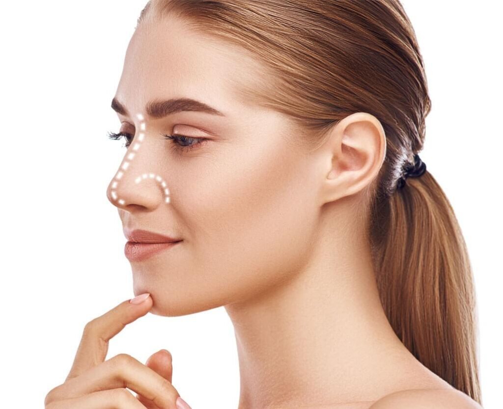 Rhinoplasty Islamabad Expert Nose Reshaping