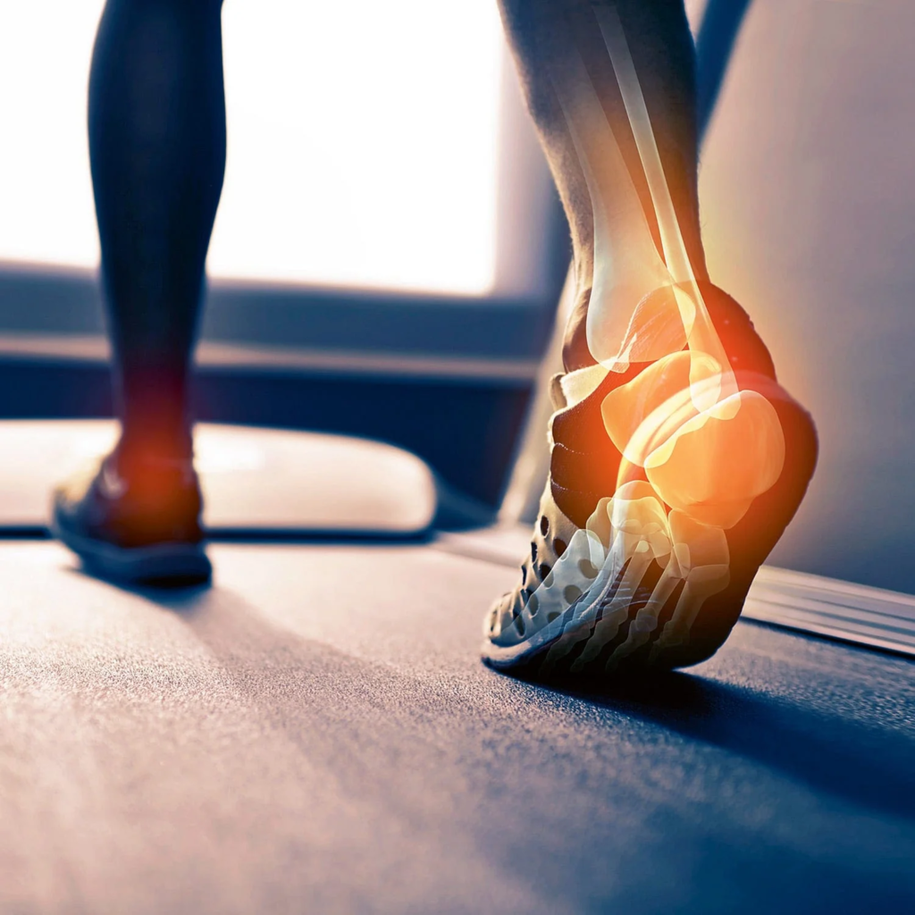 plantar fasciitis insole